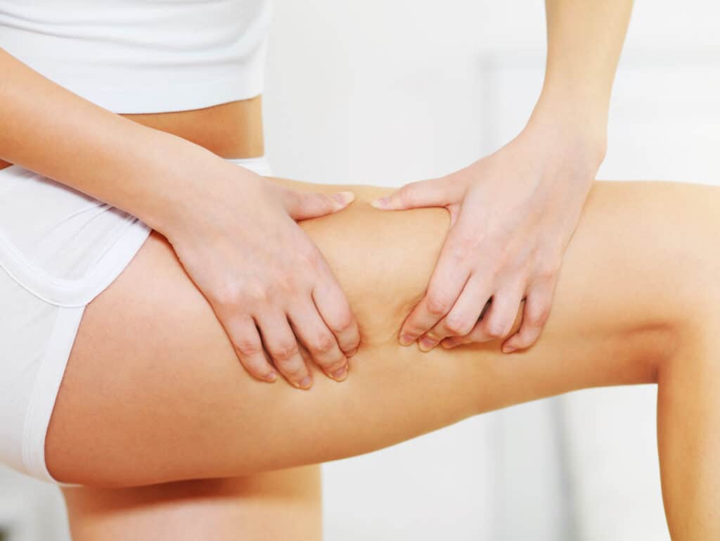 Depil&Young dispose de solutions pour combattre efficacement la cellulite