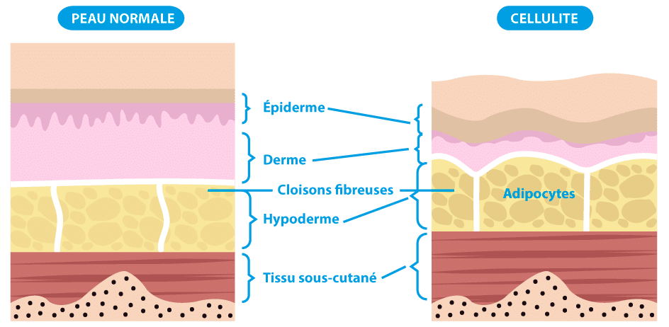 illustration des différentes couches de la peau